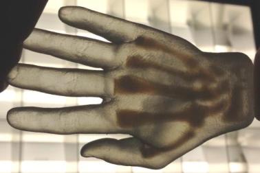 backlight showing hand bones